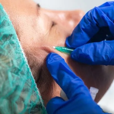 curso de hilos tensores