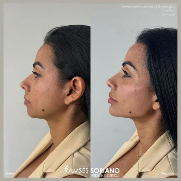 curso full face