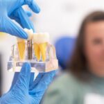 Modelo transparente de implante dental sostenido durante la practica de un curso de implantologia