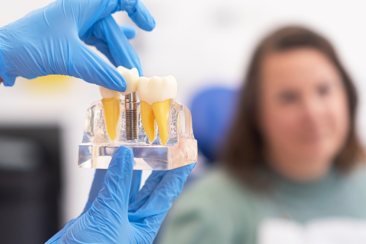 Modelo transparente de implante dental sostenido durante la practica de un curso de implantologia