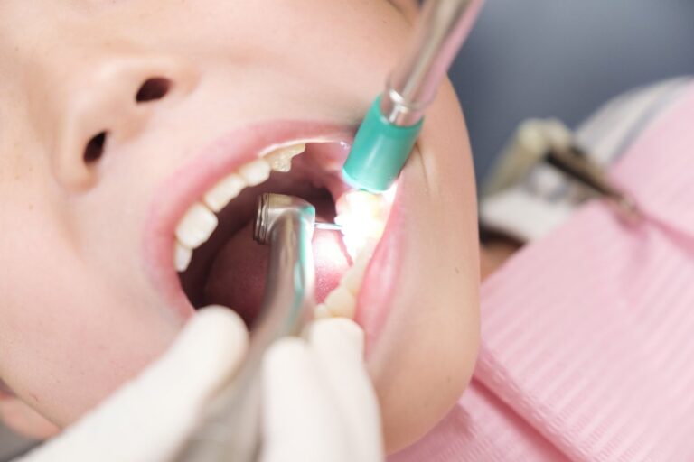 Raspado periodontal con instrumental de ultrasonidos y aspirador en la boca de un paciente