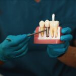 Modelo de implante dental junto a un diente natural, usado para explicar el mantenimiento periimplantario